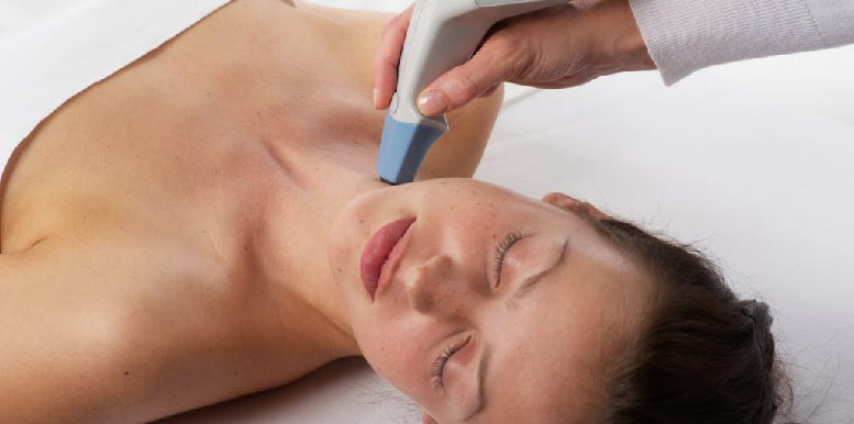 Exilis Ultra 360° radiofrekvencija